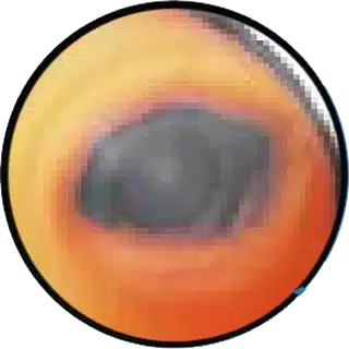 Cloudy or Bulging Eyes close-up