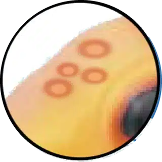 Hole-in-the-Head (HLLE) close-up