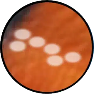 Lymphocystis close-up