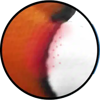 Ulcers, Sores and Wounds close-up